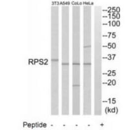 Western blot - RPS2 Antibody from Signalway Antibody (34334) - Antibodies.com