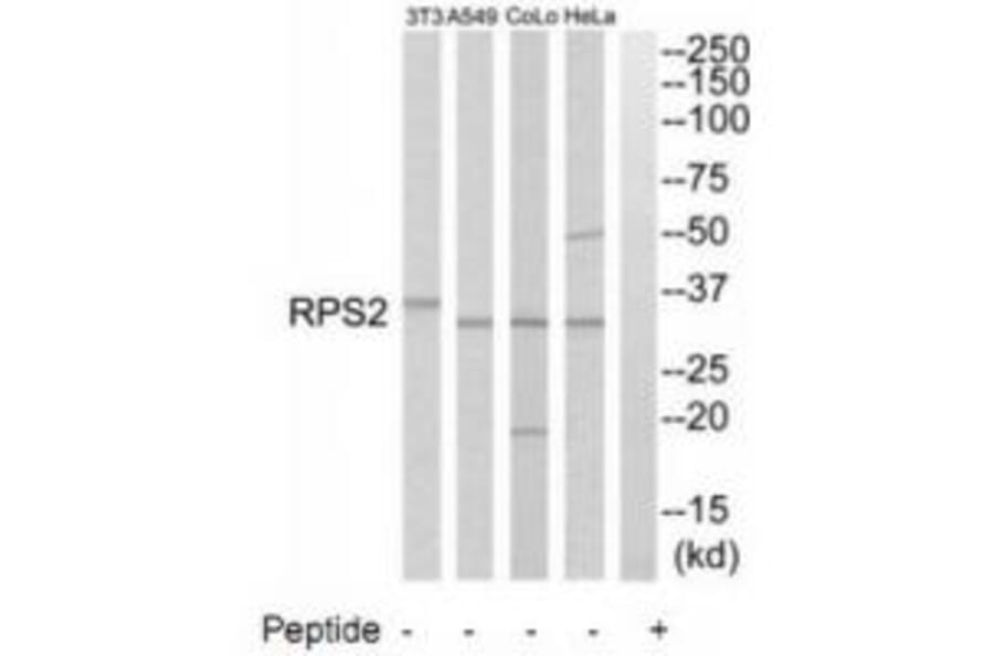 Western blot - RPS2 Antibody from Signalway Antibody (34334) - Antibodies.com