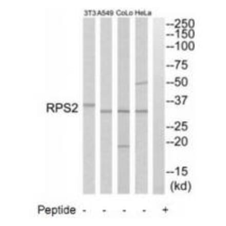 Western blot - RPS2 Antibody from Signalway Antibody (34334) - Antibodies.com