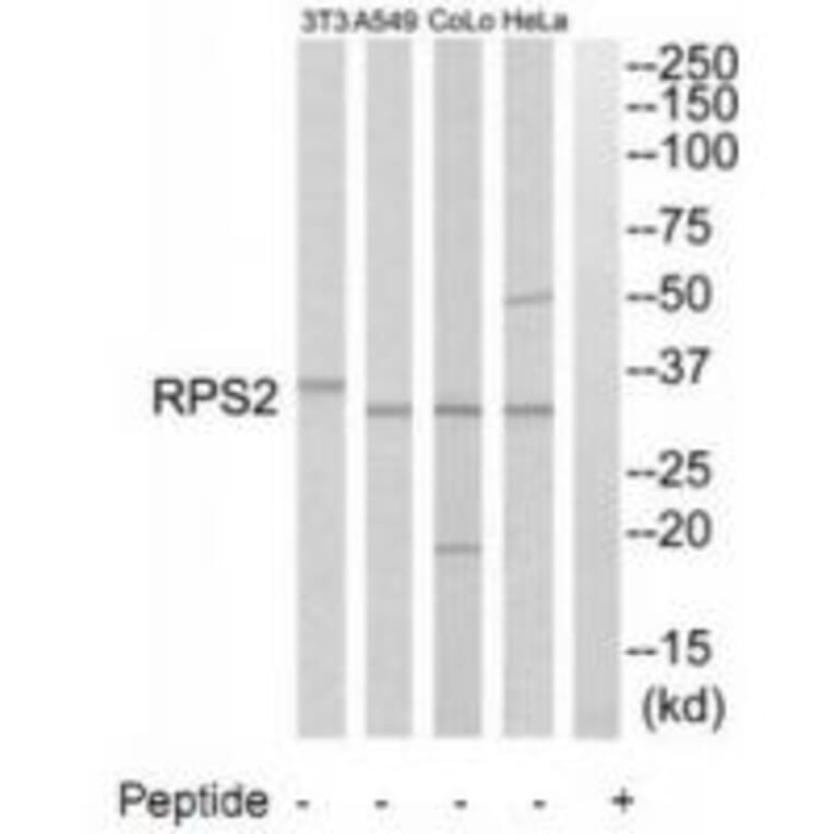 Western blot - RPS2 Antibody from Signalway Antibody (34334) - Antibodies.com