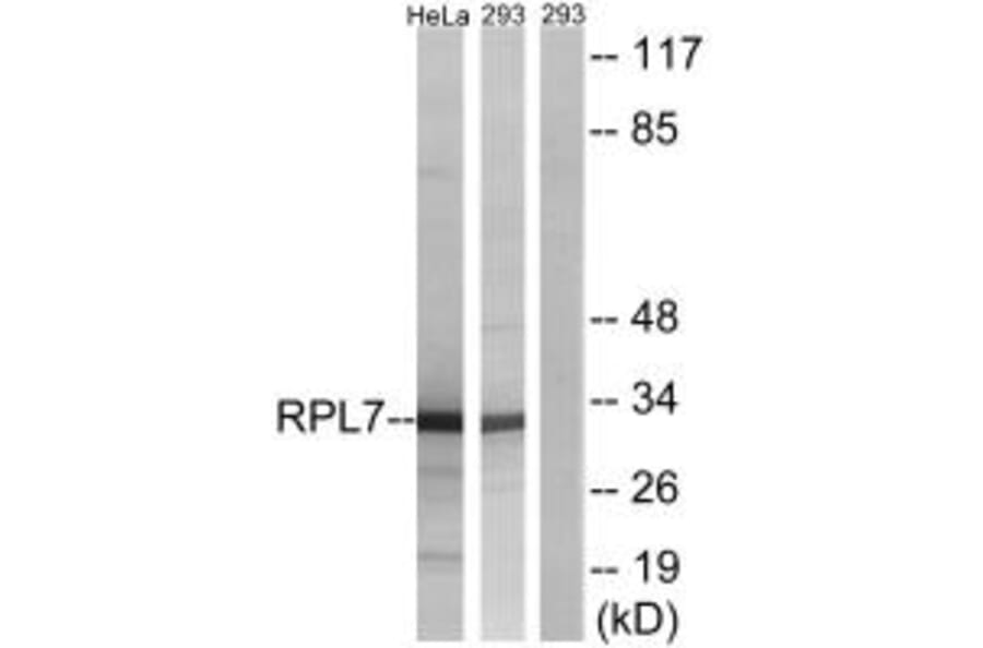 Western blot - RPL5 Antibody from Signalway Antibody (34363) - Antibodies.com