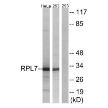 Western blot - RPL5 Antibody from Signalway Antibody (34363) - Antibodies.com
