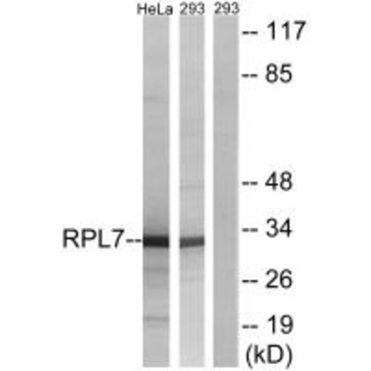 Western blot - RPL5 Antibody from Signalway Antibody (34363) - Antibodies.com