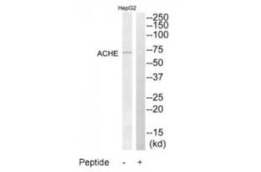 Western blot - ACHE Antibody from Signalway Antibody (34375) - Antibodies.com