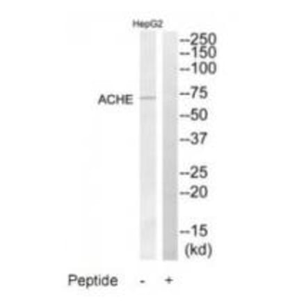 Western blot - ACHE Antibody from Signalway Antibody (34375) - Antibodies.com