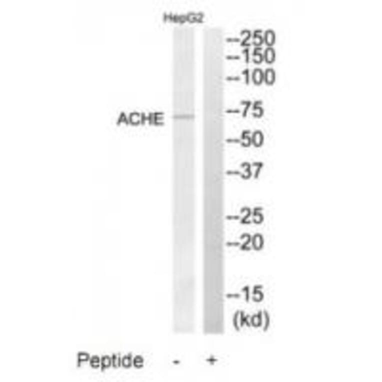 Western blot - ACHE Antibody from Signalway Antibody (34375) - Antibodies.com