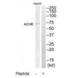Western blot - ACHE Antibody from Signalway Antibody (34375) - Antibodies.com