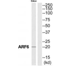 Western blot - ARF6 Antibody from Signalway Antibody (34392) - Antibodies.com