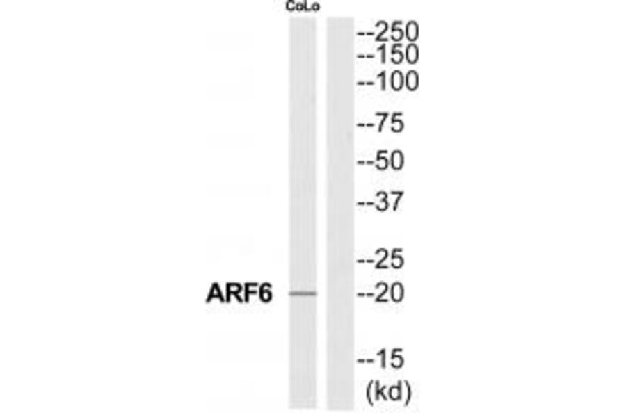 Western blot - ARF6 Antibody from Signalway Antibody (34392) - Antibodies.com