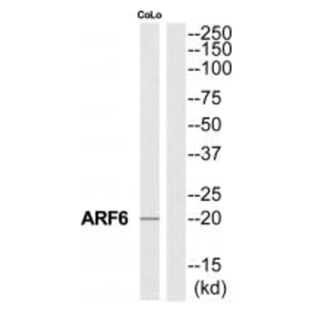 Western blot - ARF6 Antibody from Signalway Antibody (34392) - Antibodies.com
