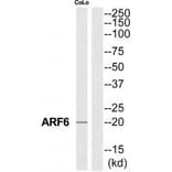 Western blot - ARF6 Antibody from Signalway Antibody (34392) - Antibodies.com