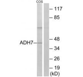 Western blot - ADH7 Antibody from Signalway Antibody (34396) - Antibodies.com