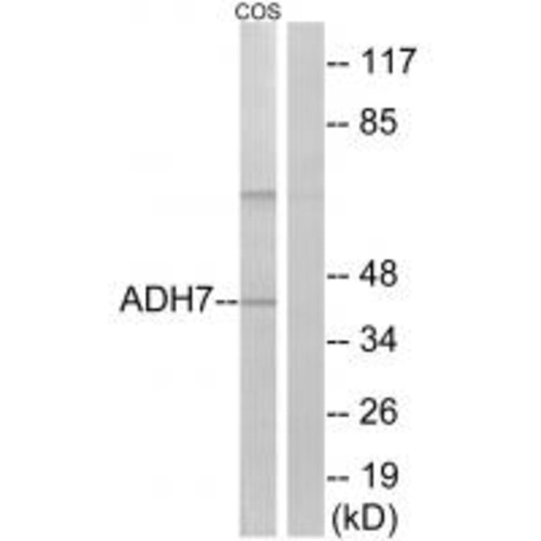 Western blot - ADH7 Antibody from Signalway Antibody (34396) - Antibodies.com