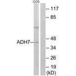 Western blot - ADH7 Antibody from Signalway Antibody (34396) - Antibodies.com