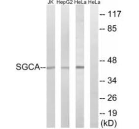 Western blot - SGCA Antibody from Signalway Antibody (34407) - Antibodies.com