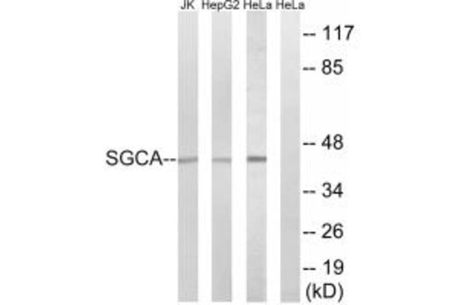 Western blot - SGCA Antibody from Signalway Antibody (34407) - Antibodies.com