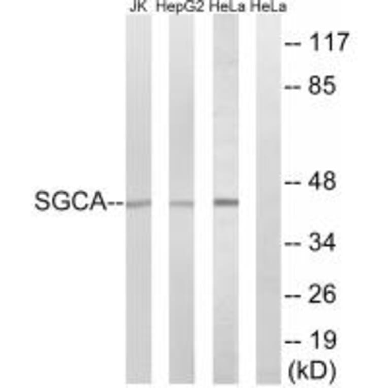 Western blot - SGCA Antibody from Signalway Antibody (34407) - Antibodies.com