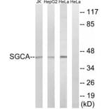 Western blot - SGCA Antibody from Signalway Antibody (34407) - Antibodies.com