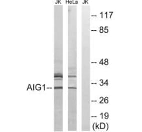 Western blot - AIG1 Antibody from Signalway Antibody (34420) - Antibodies.com