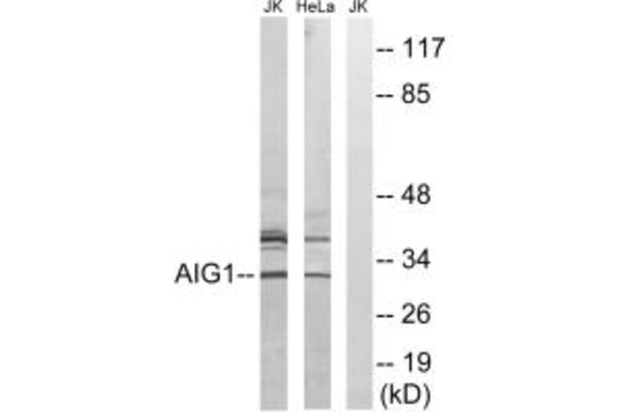 Western blot - AIG1 Antibody from Signalway Antibody (34420) - Antibodies.com