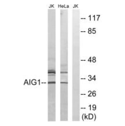 Western blot - AIG1 Antibody from Signalway Antibody (34420) - Antibodies.com