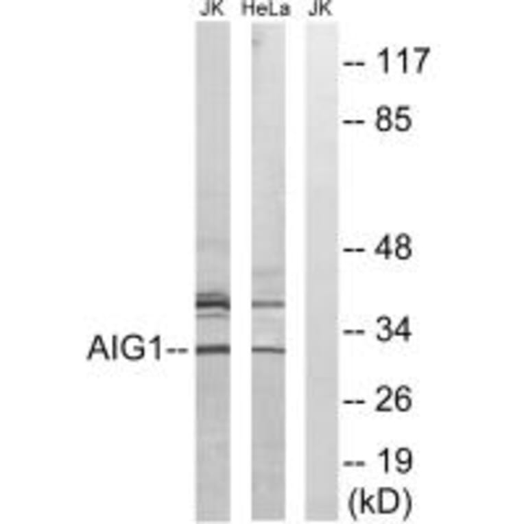 Western blot - AIG1 Antibody from Signalway Antibody (34420) - Antibodies.com