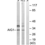 Western blot - AIG1 Antibody from Signalway Antibody (34420) - Antibodies.com
