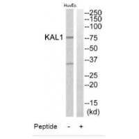 Western blot analysis of extracts from HuvEc cells, using KAL1 antibody #34427.