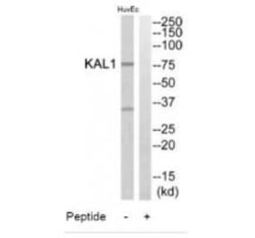 Western blot - KAL1 Antibody from Signalway Antibody (34427) - Antibodies.com