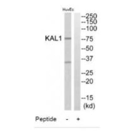 Western blot - KAL1 Antibody from Signalway Antibody (34427) - Antibodies.com