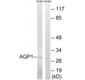 Western blot - AQP1 Antibody from Signalway Antibody (34434) - Antibodies.com