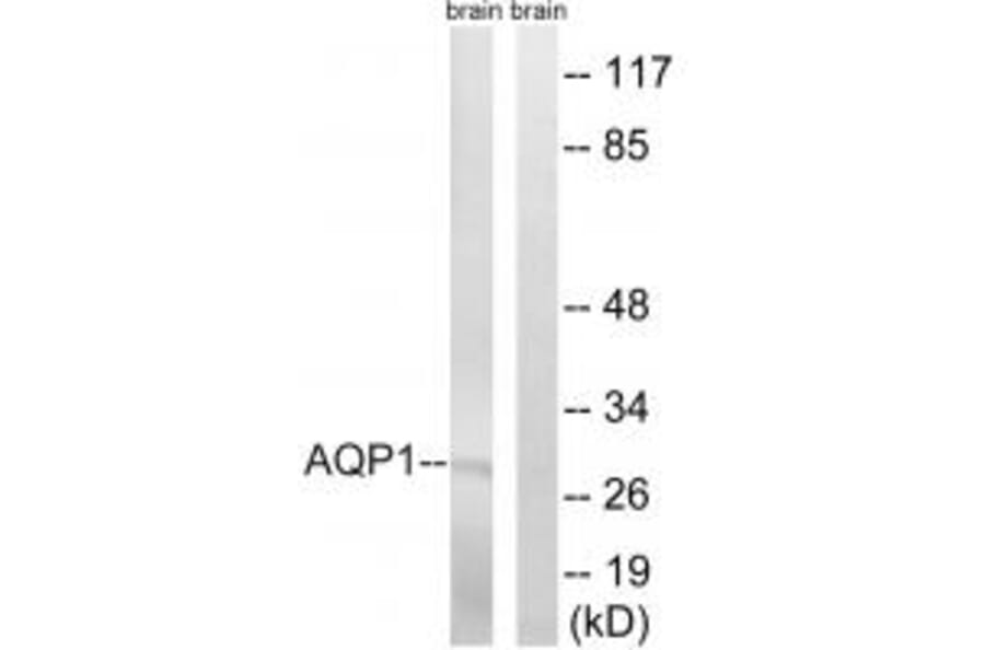 Western blot - AQP1 Antibody from Signalway Antibody (34434) - Antibodies.com