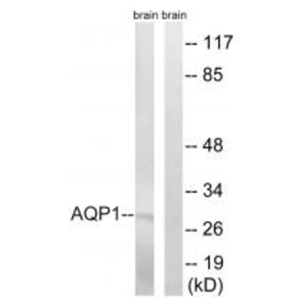 Western blot - AQP1 Antibody from Signalway Antibody (34434) - Antibodies.com
