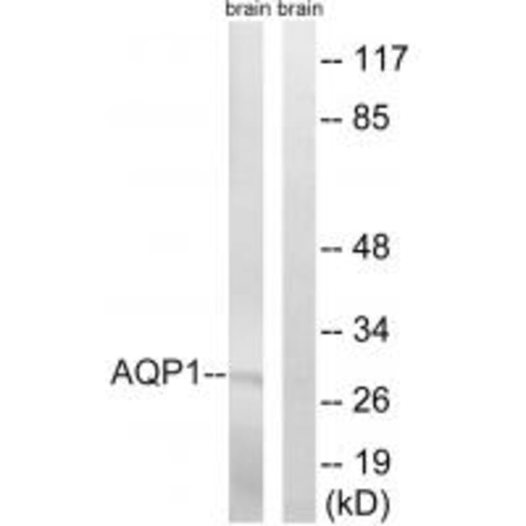 Western blot - AQP1 Antibody from Signalway Antibody (34434) - Antibodies.com