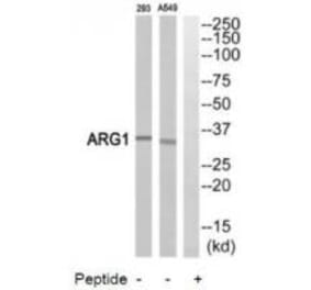 Western blot - ARG1 Antibody from Signalway Antibody (34437) - Antibodies.com