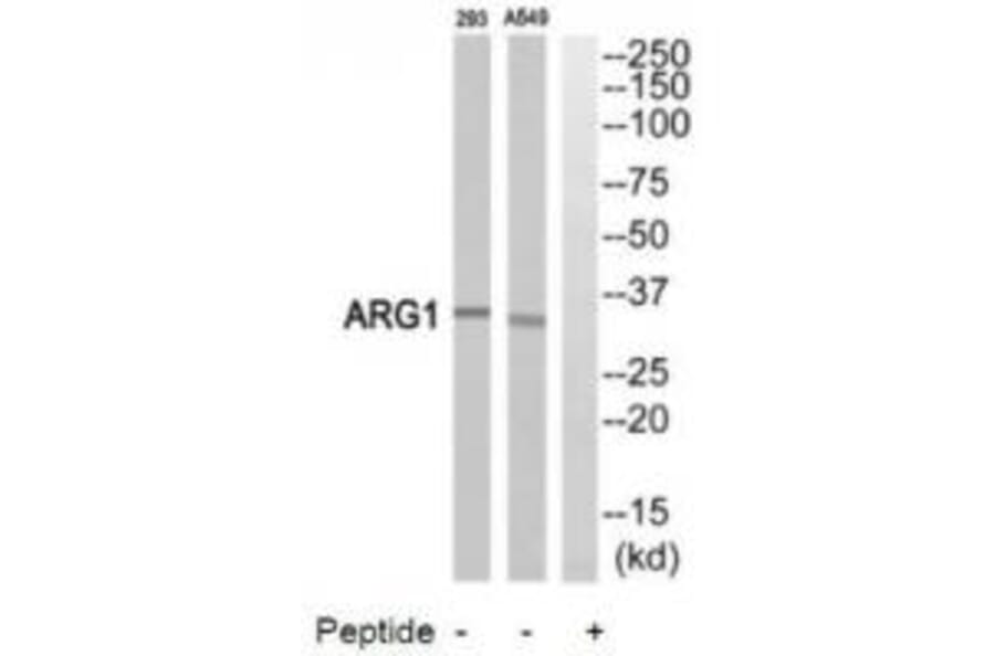 Western blot - ARG1 Antibody from Signalway Antibody (34437) - Antibodies.com