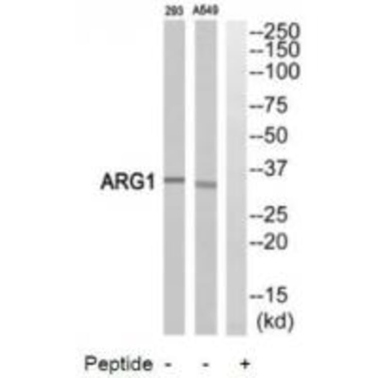 Western blot - ARG1 Antibody from Signalway Antibody (34437) - Antibodies.com