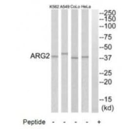 Western blot - ARG2 Antibody from Signalway Antibody (34438) - Antibodies.com