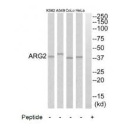 Western blot - ARG2 Antibody from Signalway Antibody (34438) - Antibodies.com