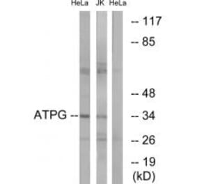Western blot - ATPG Antibody from Signalway Antibody (34449) - Antibodies.com