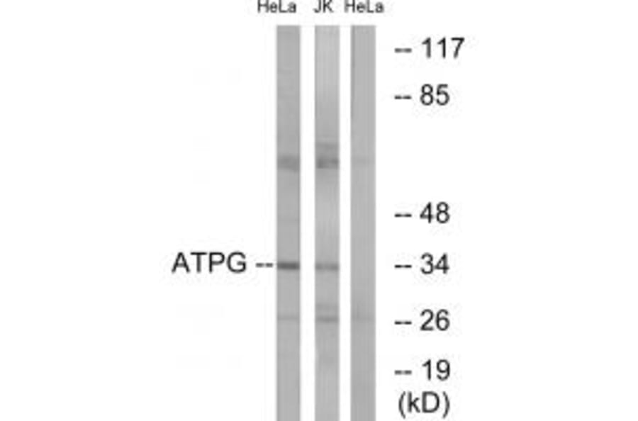 Western blot - ATPG Antibody from Signalway Antibody (34449) - Antibodies.com