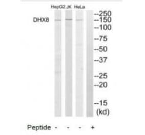 Western blot - DHX8 Antibody from Signalway Antibody (34471) - Antibodies.com