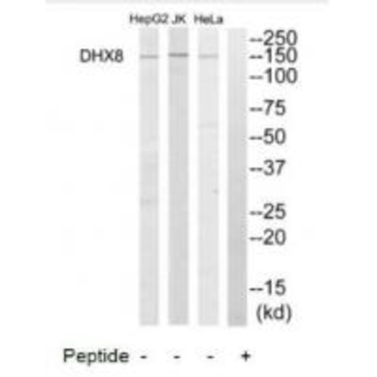 Western blot - DHX8 Antibody from Signalway Antibody (34471) - Antibodies.com