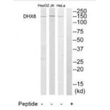 Western blot - DHX8 Antibody from Signalway Antibody (34471) - Antibodies.com