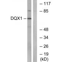 Western blot analysis of extracts from COS-7 cells, using DQX1 antibody #34472.