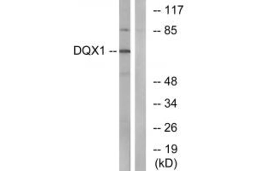 Western blot - DQX1 Antibody from Signalway Antibody (34472) - Antibodies.com