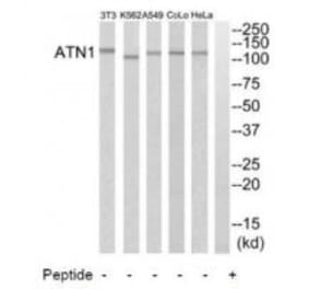 Western blot - ATN1 Antibody from Signalway Antibody (34473) - Antibodies.com