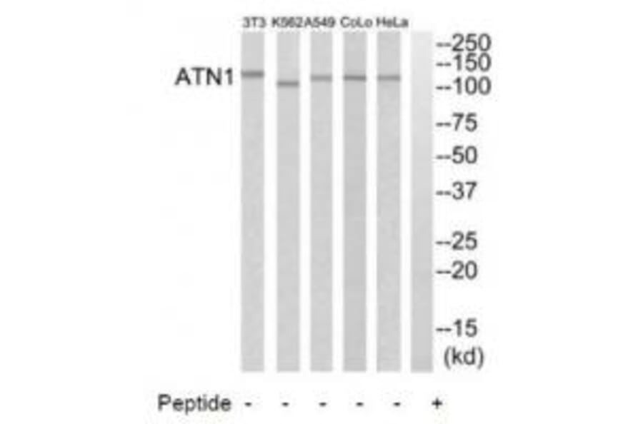 Western blot - ATN1 Antibody from Signalway Antibody (34473) - Antibodies.com