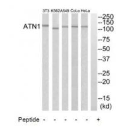 Western blot - ATN1 Antibody from Signalway Antibody (34473) - Antibodies.com