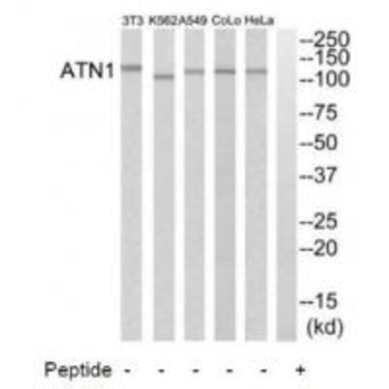 Western blot - ATN1 Antibody from Signalway Antibody (34473) - Antibodies.com